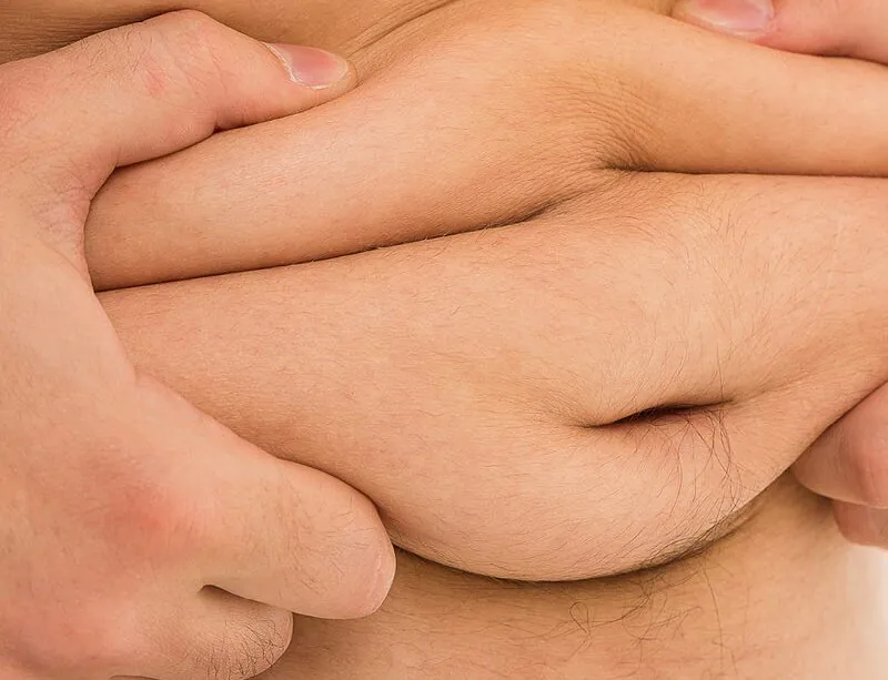 epivyziva-lexikon-nemoci-obezita